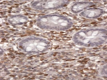 ORP3 Antibody