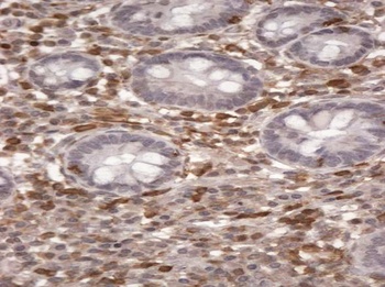 OSBPL3 Antibody