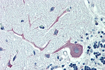 OSBPL1A Antibody