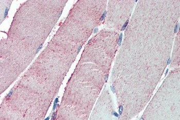 ORP1 Antibody
