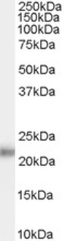 OGT Antibody