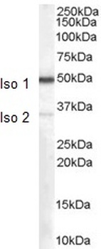 NCAM2 Antibody