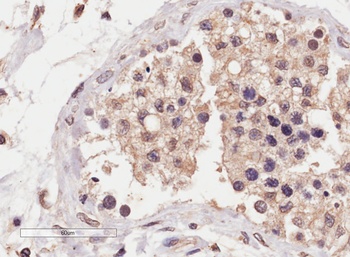 Nur77 Antibody