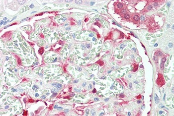 NQO1 Antibody