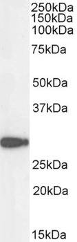 NQO1 Antibody