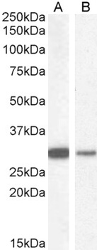 NQO1 Antibody