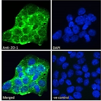 SNX1 Antibody