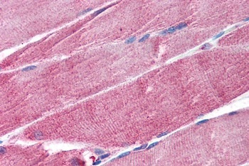 NOTCH3 Antibody