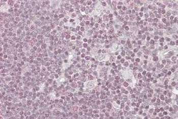 PPP1R8 Antibody