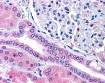 SLC9A3R2 Antibody