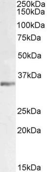 NRTN Antibody