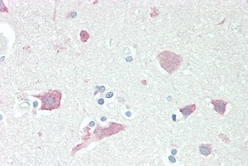 SERPINI1 Antibody