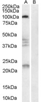 SERPINI1 Antibody