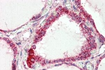 NEDD9 Antibody