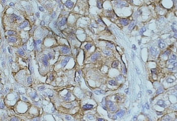 NDRG1 Antibody