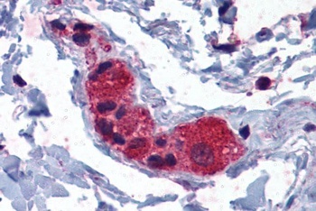 MYRIP Antibody