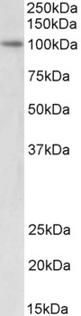 MYBL2 Antibody
