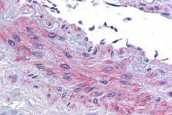 EIF5A Antibody