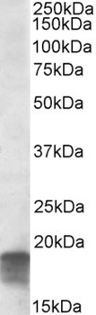 EIF5A Antibody