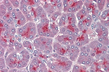 EIF5A Antibody