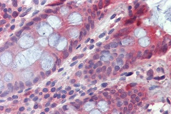 EIF5A Antibody