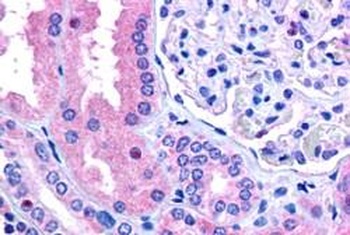 MUTYH Antibody