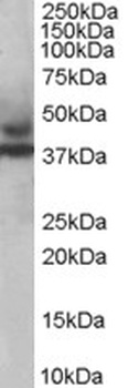 TRIM54 Antibody