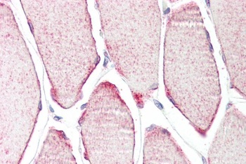 TRIM54 Antibody