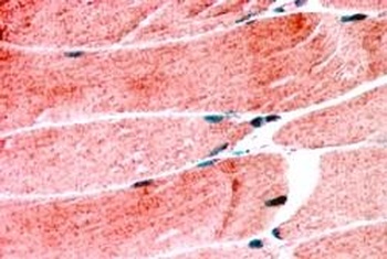 TRIM63 Antibody