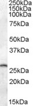 Caveolin-3 Antibody