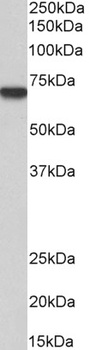 MTM1 Antibody