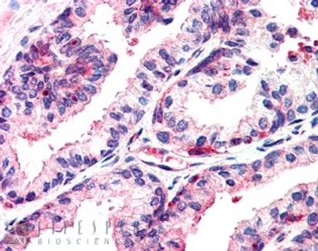 MSX1 Antibody