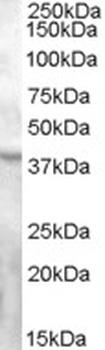 ABCC5 Antibody