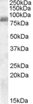 ABCC5 Antibody