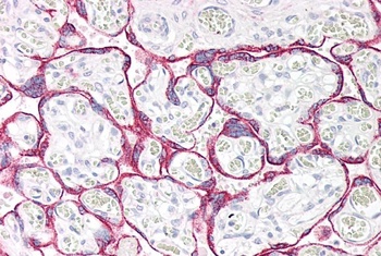MAOA Antibody