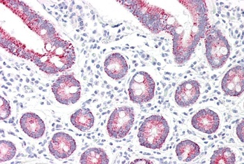 MAOA Antibody