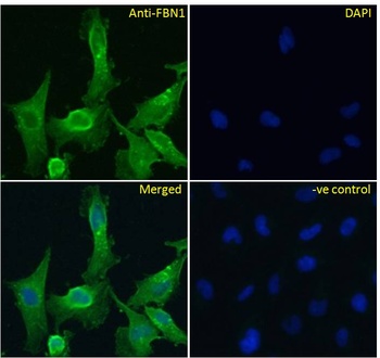 TJP1 Antibody