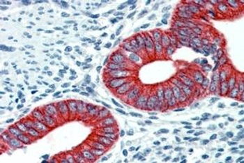 MAP3K7IP3 Antibody