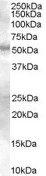 MAOB Antibody