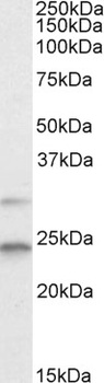 MAD2L1 Antibody
