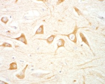 LRRK2 Antibody