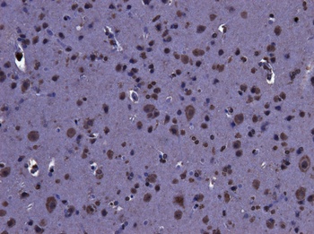 LRRK2 Antibody