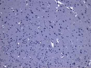 LRRK2 Antibody