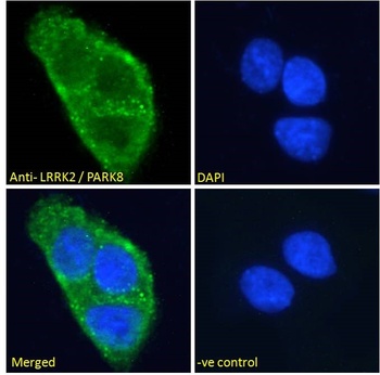 LRRK2 Antibody