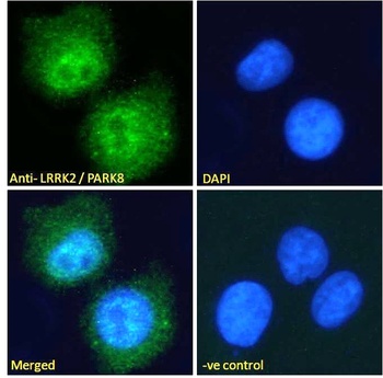 LRRK2 Antibody