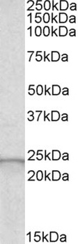 LRP5 Antibody