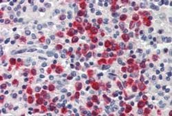 LCN2 Antibody
