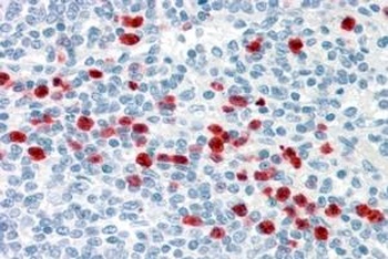 LHX2 Antibody
