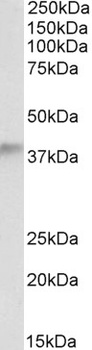 LHCGR Antibody