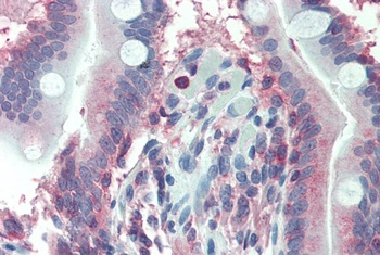 LASP1 Antibody